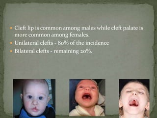  Cleft lip is common among males while cleft palate is
more common among females.
 Unilateral clefts - 80% of the incidence
 Bilateral clefts - remaining 20%.
 