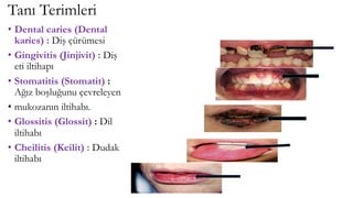 Tanı Terimleri
• Dental caries (Dental
karies) : Diş çürümesi
• Gingivitis (Jinjivit) : Diş
eti iltihapı
• Stomatitis (Stomatit) :
Ağız boşluğunu çevreleyen
• mukozanın iltihabı.
• Glossitis (Glossit) : Dil
iltihabı
• Cheilitis (Keilit) : Dudak
iltihabı
 