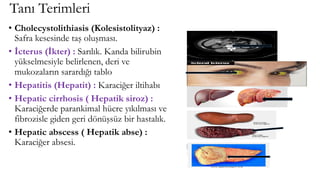 Tanı Terimleri
• Cholecystolithiasis (Kolesistolityaz) :
Safra kesesinde taş oluşması.
• İcterus (İkter) : Sarılık. Kanda bilirubin
yükselmesiyle belirlenen, deri ve
mukozaların sarardığı tablo
• Hepatitis (Hepatit) : Karaciğer iltihabı
• Hepatic cirrhosis ( Hepatik siroz) :
Karaciğerde parankimal hücre yıkılması ve
fibrozisle giden geri dönüşsüz bir hastalık.
• Hepatic abscess ( Hepatik abse) :
Karaciğer absesi.
 
