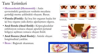 Tanı Terimleri
• Hemorrhoid (Hemoroid) : Anüs
çevresindeki genişleyen venlerin meydana
getirdiği meme şeklindeki oluşum. Basur.
• Fistula (Fistül) : İçi boş bir organın başka bir
içi boş organa yada deriye ağızlaşması olgusu.
• Anal fistula (Anal fistül) : Kriptoglandular
enfeksiyon sonucu oluşan apseleri perianal
bölgeye açılması sonucu oluşan fistül.
• Anal fissura (Anal fissür) : Anüsle oluşan
longittudinal yarıklar.
• İleus : Bağırsak tıkanması.
 