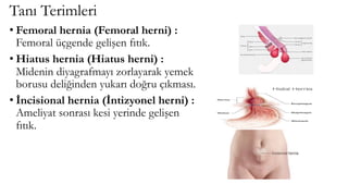 Tanı Terimleri
• Femoral hernia (Femoral herni) :
Femoral üçgende gelişen fıtık.
• Hiatus hernia (Hiatus herni) :
Midenin diyagrafmayı zorlayarak yemek
borusu deliğinden yukarı doğru çıkması.
• İncisional hernia (İntizyonel herni) :
Ameliyat sonrası kesi yerinde gelişen
fıtık.
 