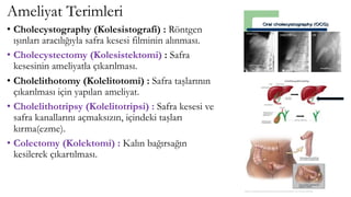 Ameliyat Terimleri
• Cholecystography (Kolesistografi) : Röntgen
ışınları aracılığıyla safra kesesi filminin alınması.
• Cholecystectomy (Kolesistektomi) : Safra
kesesinin ameliyatla çıkarılması.
• Cholelithotomy (Kolelitotomi) : Safra taşlarının
çıkarılması için yapılan ameliyat.
• Cholelithotripsy (Kolelitotripsi) : Safra kesesi ve
safra kanallarını açmaksızın, içindeki taşları
kırma(ezme).
• Colectomy (Kolektomi) : Kalın bağırsağın
kesilerek çıkartılması.
 