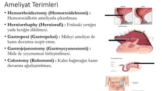 Ameliyat Terimleri
• Hemorrhoidectomy (Hemorroidektomi) :
Hemorooidlerin ameliyatla çıkarılması.
• Herniorrhaphy (Herniorafi) : Fıtıktaki yırtığın
yada kesiğin dikilmesi.
• Gastropexi (Gastropeksi) : Mideyi ameliyat ile
karın duvarına tespit etme.
• Gastrojejunostomy (Gastroyeyunostomi) :
Mide ile yeyenumun birleştirilmesi.
• Colostomy (Kolostomi) : Kalın bağırsağın karın
duvarına ağızlaştırılması.
 
