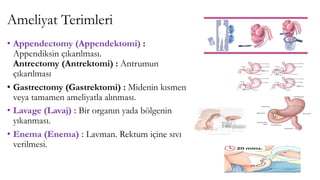 Ameliyat Terimleri
• Appendectomy (Appendektomi) :
Appendiksin çıkarılması.
Antrectomy (Antrektomi) : Antrumun
çıkarılması
• Gastrectomy (Gastrektomi) : Midenin kısmen
veya tamamen ameliyatla alınması.
• Lavage (Lavaj) : Bir organın yada bölgenin
yıkanması.
• Enema (Enema) : Lavman. Rektum içine sıvı
verilmesi.
 