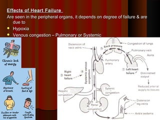 Effects of Heart FailureEffects of Heart Failure
Are seen in the peripheral organs, it depends on degree of failure & areAre seen in the peripheral organs, it depends on degree of failure & are
due todue to
 HypoxiaHypoxia
 Venous congestion – Pulmonary or SystemicVenous congestion – Pulmonary or Systemic
1010
 