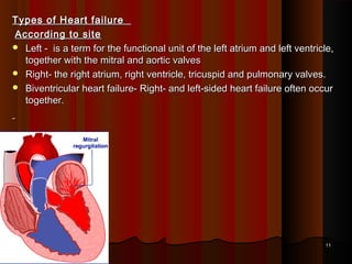 Types of Heart failure  Types of Heart failure  
According to siteAccording to site
 Left - is a term for the functional unit of the left atrium and left ventricle,Left - is a term for the functional unit of the left atrium and left ventricle,
together with the mitral and aortic valvestogether with the mitral and aortic valves
 Right- the right atrium, right ventricle, tricuspid and pulmonary valves.Right- the right atrium, right ventricle, tricuspid and pulmonary valves.
 Biventricular heart failure- Right- and left-sided heart failure often occurBiventricular heart failure- Right- and left-sided heart failure often occur
together.together.
1111
 