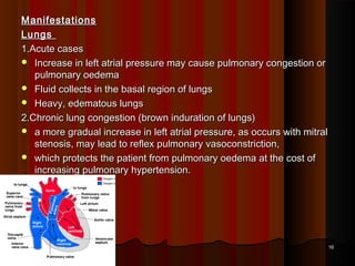 ManifestationsManifestations
LungsLungs
1.Acute cases1.Acute cases
 Increase in left atrial pressure may cause pulmonary congestion orIncrease in left atrial pressure may cause pulmonary congestion or
pulmonary oedemapulmonary oedema
 Fluid collects in the basal region of lungsFluid collects in the basal region of lungs
 Heavy, edematous lungsHeavy, edematous lungs
2.Chronic lung congestion (brown induration of lungs)2.Chronic lung congestion (brown induration of lungs)
 a more gradual increase in left atrial pressure, as occurs with mitrala more gradual increase in left atrial pressure, as occurs with mitral
stenosis, may lead to reflex pulmonary vasoconstriction,stenosis, may lead to reflex pulmonary vasoconstriction,
 which protects the patient from pulmonary oedema at the cost ofwhich protects the patient from pulmonary oedema at the cost of
increasing pulmonary hypertension.increasing pulmonary hypertension.
1616
 