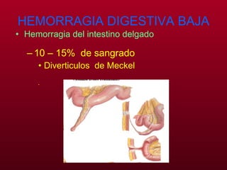 HEMORRAGIA DIGESTIVA BAJA Hemorragia del intestino delgado 10 – 15%  de sangrado Diverticulos  de Meckel 