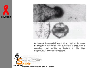 
HIV/SIDA

A human immunodeficiency viral particle is seen
budding from the infected cell surface at the top, with a
complete viral particle at bottom in this high
magnification electron micrograph.

Saúde

Escola Cooperativa de Vale S. Cosme

 