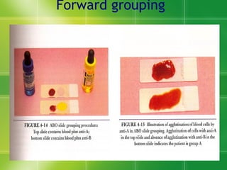 Forward grouping 