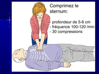 Comprimez le
sternum:
- profondeur de 5-6 cm
- fréquence 100-120 /min
- 30 compressions
 
