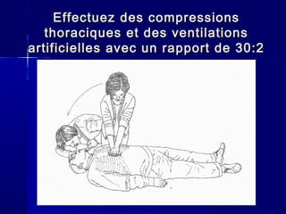 EffectuezEffectuez des compressionsdes compressions
thoraciquesthoraciques et des ventilationset des ventilations
artificiellesartificielles avec un rapport de 30:2avec un rapport de 30:2
 