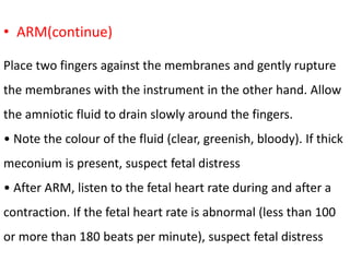 Arm Induction 4 Induction of labour.pptx