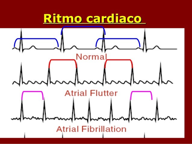 4 interpretaci n_cl_nica_del_ecg_normal