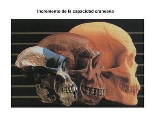 Incremento de la capacidad craneana
 