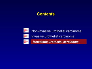 Contents Non-invasive urothelial carcinoma Invasive urothelial carcinoma Metastatic urothelial carcinoma 