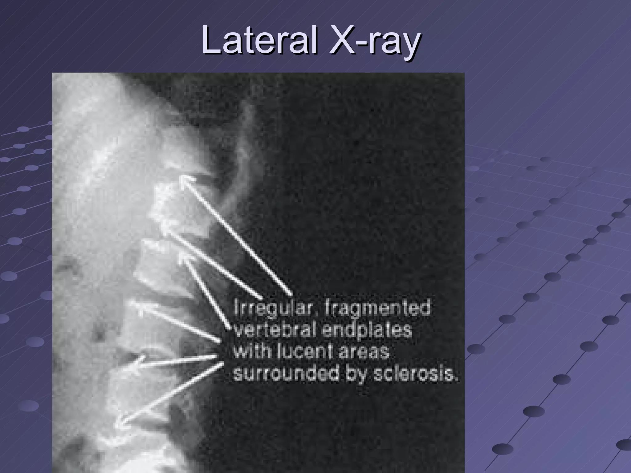 Lateral X-ray  