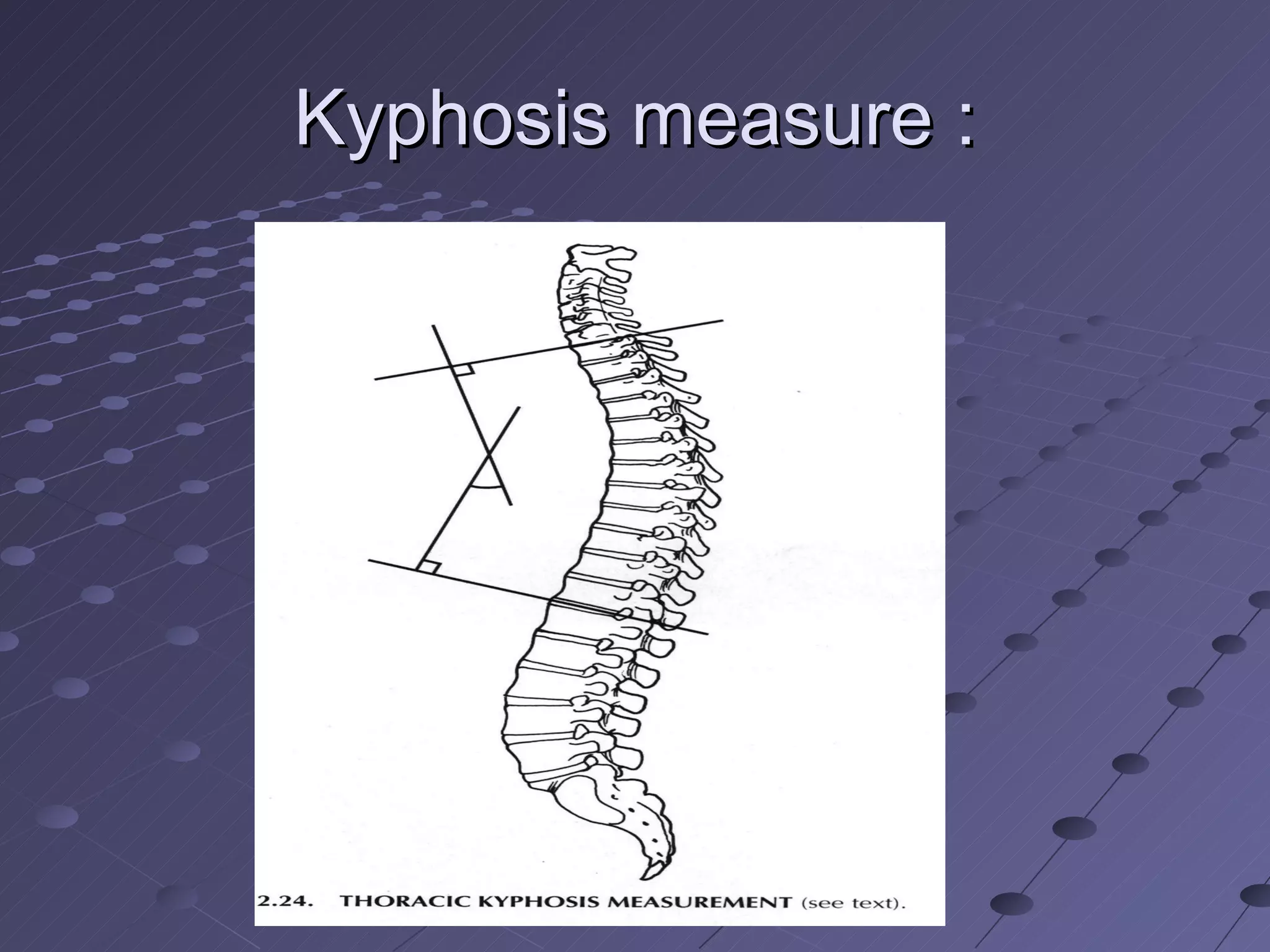 Kyphosis measure : 