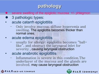 4 laryngeal disorders | PPT