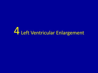 4 left ventricular enlargement | PPTX
