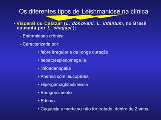 Os diferentes tipos de Leishmaniose na clínica
• Visceral ou Calazar ( L. donovani, L. infantum , no Brasil
causada por L. chagasi ):
- Enfermidade crônica
- Caracterizada por:
• febre irregular e de longa duração
• hepatoesplenomegalia
• linfoadenopatia
• Anemia com leucopenia
• Hipergamaglobulinemia
• Emagrecimento
• Edema
• Caquexia e morte se não for tratado, dentro de 2 anos

 