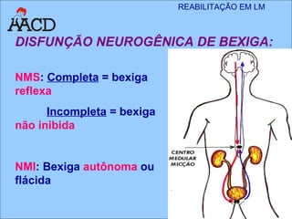 DISFUNÇÃO NEUROGÊNICA DE BEXIGA: NMS :  Completa  = bexiga  reflexa Incompleta  = bexiga  não inibida NMI : Bexiga  autônoma  ou flácida 