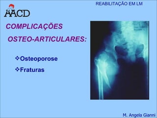 Osteoporose Fraturas COMPLICAÇÕES OSTEO-ARTICULARES: 
