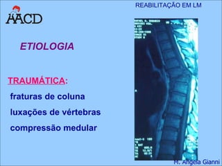 ETIOLOGIA TRAUMÁTICA :   fraturas de coluna luxações de vértebras compressão medular 