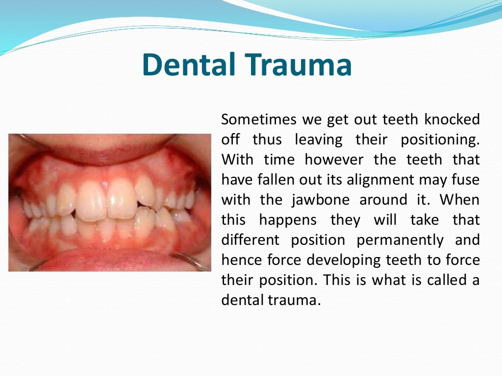 dental trauma essay dental trauma essay