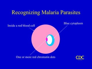 Recognizing Malaria Parasites
Inside a red blood cell
One or more red chromatin dots
Blue cytoplasm
 