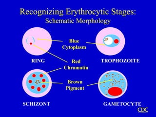 RING TROPHOZOITE
SCHIZONT GAMETOCYTE
Blue
Cytoplasm
Red
Chromatin
Brown
Pigment
Recognizing Erythrocytic Stages:
Schematic Morphology
 