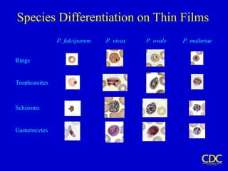 Species Differentiation on Thin Films
P. falciparum P. vivax P. ovale P. malariae
Rings
Trophozoites
Schizonts
Gametocytes
 