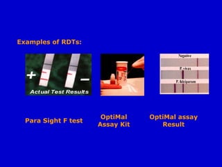 Examples of RDTs:
Para Sight F test
OptiMal
Assay Kit
OptiMal assay
Result
 