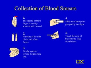 Collection of Blood Smears
5.
Touch the drop of
blood to the slide
from below.
4.
Slide must always be
grasped by its edges.
2.
Puncture at the side
of the ball of the
finger.
3.
Gently squeeze
toward the puncture
site.
1.
The second or third
finger is usually
selected and cleaned.
 