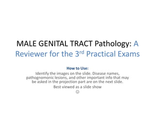 MALE GENITAL TRACT Pathology: A Reviewer for the 3rd Practical Exams How to Use:  Identify the images on the slide. Disease names, pathognomonic lesions, and other important info that may be asked in the projection part are on the next slide. Best viewed as a slide show   