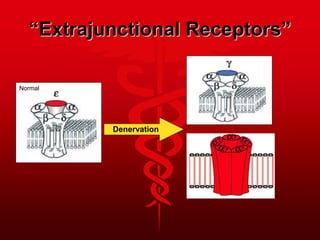 “Extrajunctional Receptors”
Normal
Denervation
 