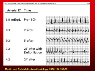 Martin and Richtsfeld, Anesthesiology, 2006;104:158-69
 