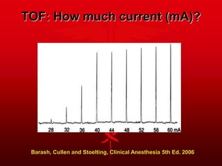 TOF: How much current (mA)?
Barash, Cullen and Stoelting, Clinical Anesthesia 5th Ed. 2006
 