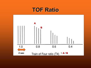 TOF Ratio
2 sec
A
B
= A / B
 