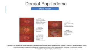 ilmu kesehatan mata, dokter mata, mata tenang | PDF
