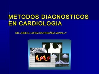 METODOS DIAGNOSTICOSMETODOS DIAGNOSTICOS
EN CARDIOLOGIAEN CARDIOLOGIA
DR. JOSE E. LOPEZ SANTIBAÑEZ McNALLYDR. JOSE E. LOPEZ SANTIBAÑEZ McNALLY
 