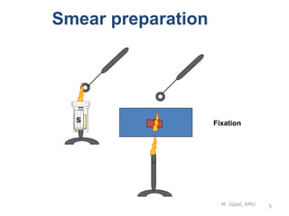 M. Iqbal, KMU 5
Smear preparation
S Fixation
 