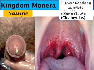 Kingdom Monera
2. อาณาจักรย่อยยู
แบคทีเรีย
(Subkingdom
Eubacteria)
กลุ่มคลาไมเดีย
(Chlamydias)
Neisseria
gonorrhoea
e
 