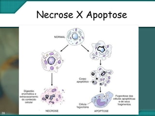 39
Necrose X Apoptose
 