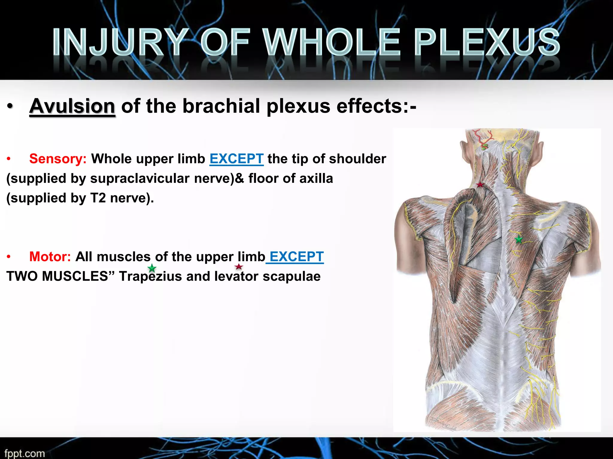 Brachial Plexus Injuries by rayan alhumaid | PDF