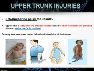 Brachial Plexus Injuries by rayan alhumaid | PPT