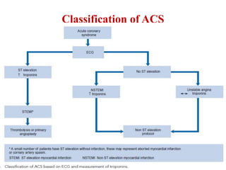Classification of ACS
 
