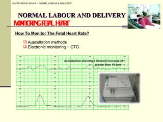 4 normal labour and delivery | PPT