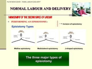 Classical Incision Labour 4 normal labour and delivery | PPT