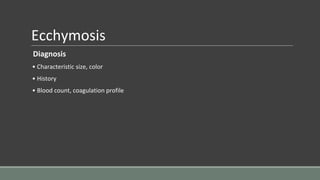 Ecchymosis
Diagnosis
• Characteristic size, color
• History
• Blood count, coagulation profile
 